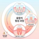 31140-6-29-7 | 아기 이중치 원인부터 관리까지 총정리｜생후7개월 소아치과 융합치 판정 후기