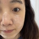 애기피부1호 | 송도피부관리샵 에스테티아 송도 스페셜 모공앰플관리 받고 애기피부된 썰 풀러왓따