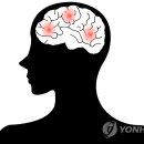 뇌졸중 이미지