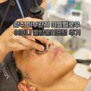 시청로 | 광주 피부관리 미엘멜로우 어머니 물방울리프팅 후기