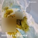 돌아기 면역력 저하 감기, 코변 장염, 소아치과 방문