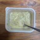 오제석치과의원 | 사랑니 발치 후기..🦷💔