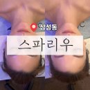 삼성메디칼 | ［ 강남 / 삼성 ] 강남피부관리 스파리우 삼성 | 안티에이징케어 MTS 관리