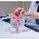 이효진여성의원 | 미레나 시술, 임신 가능성만큼 중요한 건