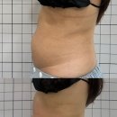 태크니끄 이미지