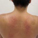 차봄헬스케어 | 이천 피부관리&amp;체형관리 에스테틱 &lt; 썬샤인 스킨케어 &gt; 수기 케어 대박 찐찐 내돈내산 후기