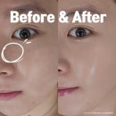 동해시-14 | 동해피부관리 에스테틱 김서이피부연구소 케라손 후기