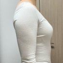 [ 대구 ] 팔뚝 지방흡입 수술 후기 / 하게 된 이유, 병원 결정 계기, 당일, 통증, 회복