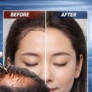 닥터안헤어플란트의원 네이버블로그