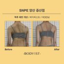 KOP’S 안경 | SNPE 양산SNPE 척추측만증에 대해 함께 알아봐요:)