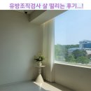 유방조직검사후기 비용부터 주의사항, 결과듣기까지의 살떨리는 과정