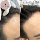 마음에 점을 찍다 이미지