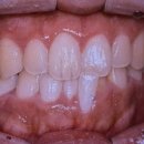 미푸른치과의원 이미지