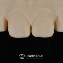 훈 기공소 이미지