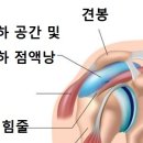 극상근과 견봉하 삼각근하 점액낭염 이미지