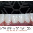 스노우기공소 이미지