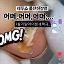 레푸스 진장점 네이버블로그