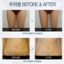 강남연세라인의원 Daum카페