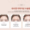 온유성형외과의원 네이버블로그