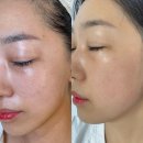 매료 | &lt;진해&gt; 진해피부관리 미백토닝후기 / 매료뷰티