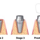 자연치과기공소 이미지