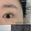 더모먼트 이미지