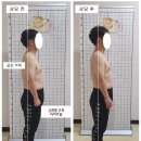 김영길한의원 | 유성체형교정, 목통증으로 도수치료와 주사를 맞아 봤지만 근본적인 원인을 해결하지 못했어요.