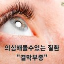 울산제일안과 이미지