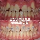 양산이루미치과의원 네이버블로그