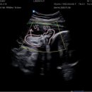 리베르여성병원 이미지