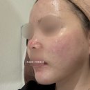 몰리는 인기 터진 1인 피부관리샵 대전 ‘호야뷰티‘ 내돈내산 시술 후기 | 가격 대기시간 예약 정보