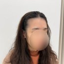 전주 두피문신 smp 헤어라인 후기 삼천동 오너프스튜디오