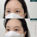펄미에이트 이미지