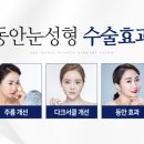 이원제성형외과 이미지