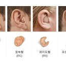 이 보청기 이미지
