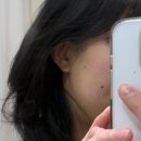 일산) 정발산 피부관리, 도테라오일, 건조한 여드름 피부, MTS 후기여드름 피부관리후기[미엘스킨앤바디]