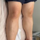 미나피부관리실 | 창원에스테틱 미나다움 에스테틱 저자극 남자다리왁싱 후기