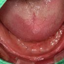 아치치과기공소 이미지