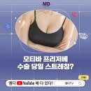 엠디외과의원 | 모티바 프리저베, 가슴수술 회복기간이 부담된다면? | 모티바프리저베후기