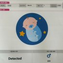 임신 12주~18주 [ 원주우리산부인과 니프티 플러스 재검 / 성별확인 / 일본여행 / 소양증 증상 완화]