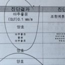 북춘천 현대서비스 이미지