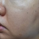 [원드랍 미라클 원파운데이션]스며들듯 밀착되는 피팅파운데이션