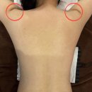 옷거리 | 춘천 피부관리샵 지나스킨케어 다이어트할 때 꼭 필요한 배농관리 림프선관리 후기