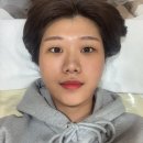 인모어뷰티 | 선릉여드름 자국까지 없애는 인모어뷰티에서 도자기필, 물방울LDM 관리받은 후기