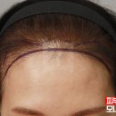 여성헤어 이미지