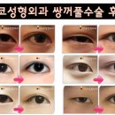 내일엔성형외과의원 네이버블로그