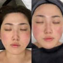 합정피부관리 '더마7 에스테틱 합정점' 피부진단부터 맞춤관리 후기