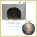 일러스라인 이미지