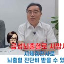 급성뇌출혈로 사망한 경우 뇌출혈 진단비 받을 수 있을까. 이미지