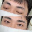 아인뷰티의원 이미지